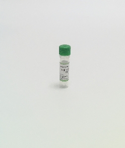 5×Protein Loading Buffer (with DTT)